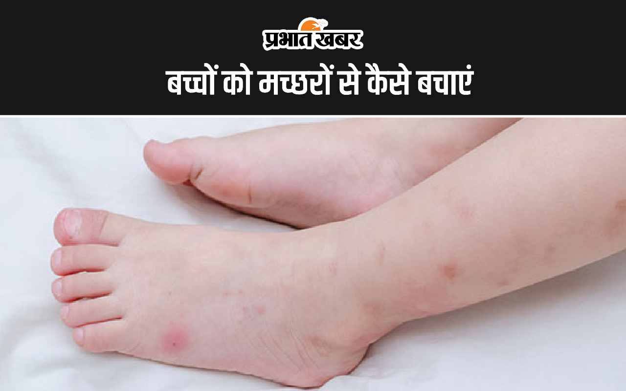 mosquito-bites:-बच्चों-को-मच्छरों-से-कैसे-बचाएं-जानिए-आसान-टिप्स